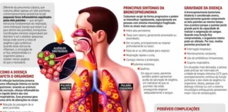 Quadro de Bolsonaro é grave